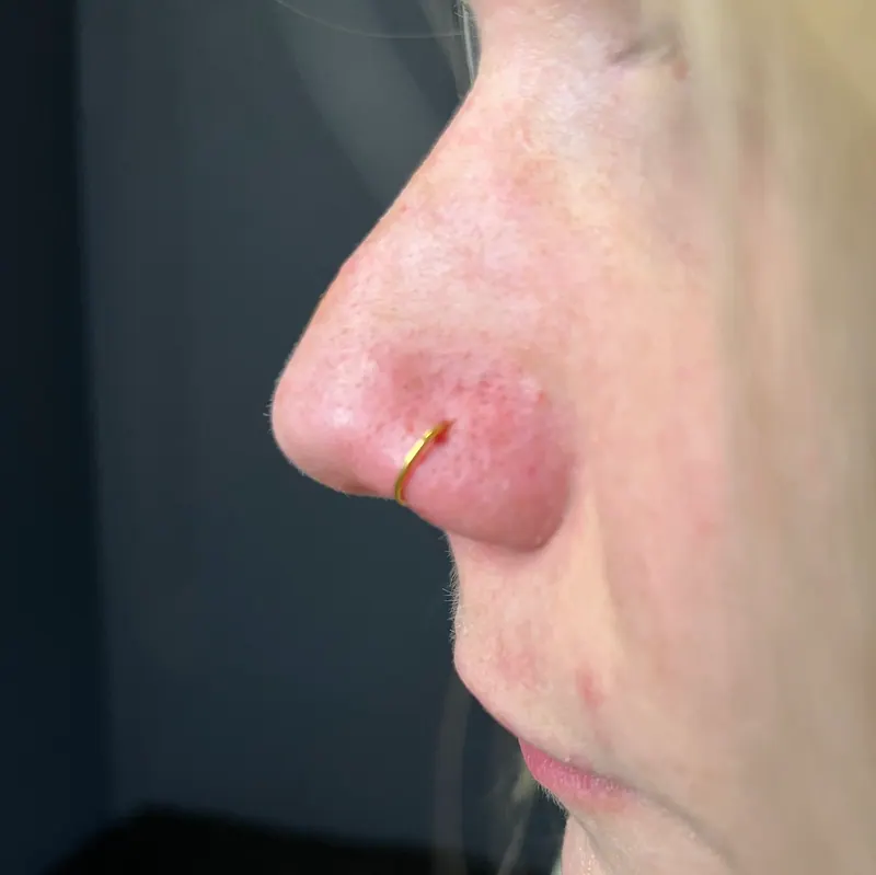 Nostril-Piercing mit goldenem Ring, gestochen von Levent